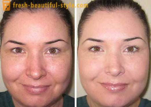 Toner untuk muka - apakah ia, dan bagaimana untuk menggunakannya? Skin Care Products Face