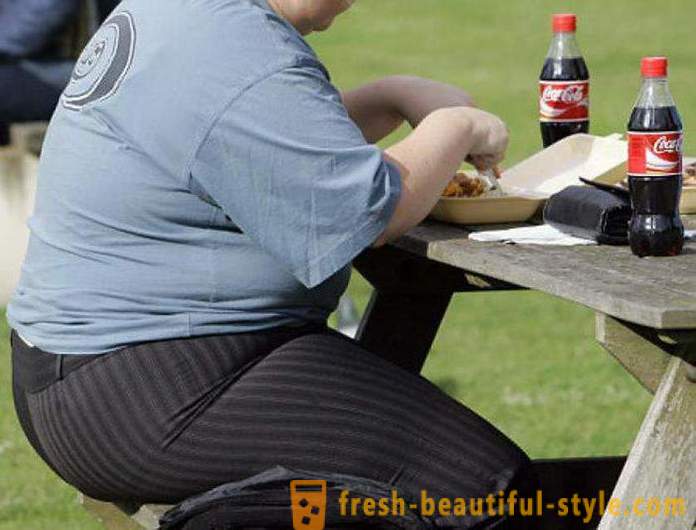Pencegahan obesiti. Sebab dan akibat obesiti. Masalah obesiti di dunia
