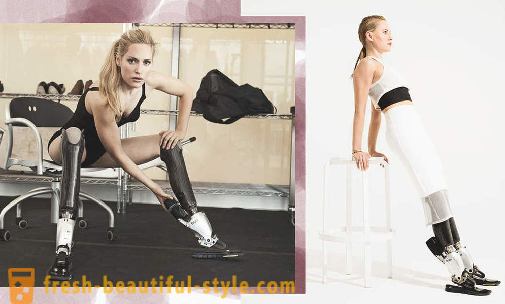 Beauty Infinite: 6 model wanita dengan prostesis