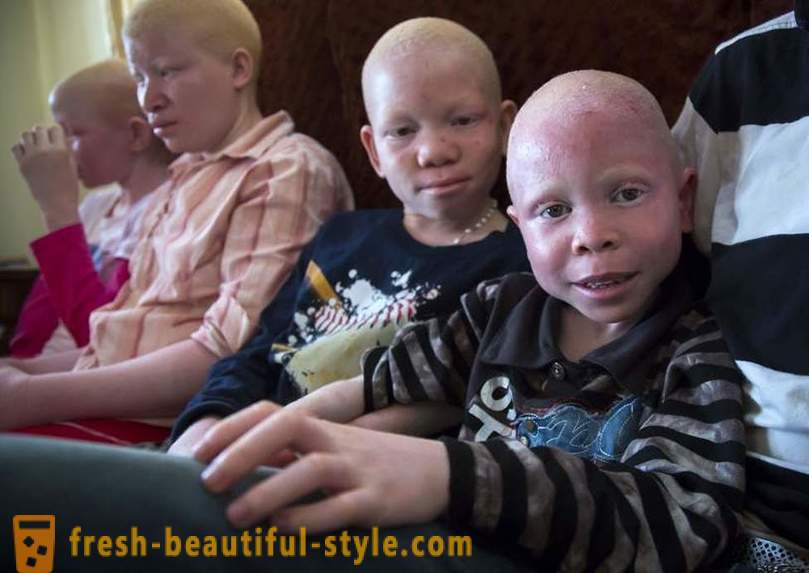 Sejarah tragis Tanzanian albinos