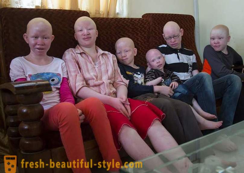 Sejarah tragis Tanzanian albinos