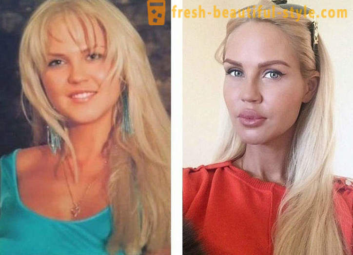 10 keindahan Rusia sebelum dan selepas plastik