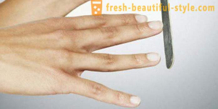 Bintik putih pada kuku jari: punca-punca dan rawatan