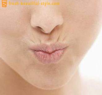 Bagaimana untuk membersihkan kedutan pada bibir atas dalam kosmetologi?