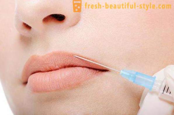 Bagaimana untuk membersihkan kedutan pada bibir atas dalam kosmetologi?