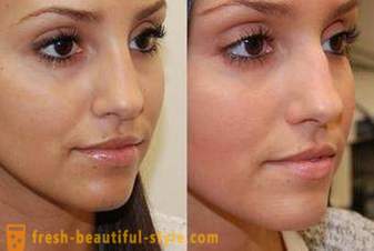 Bagaimana untuk mengurangkan hidung dengan makeup? Visual mengurangkan hidung