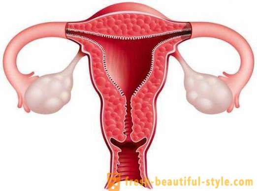 Bagaimana untuk meningkatkan endometrium