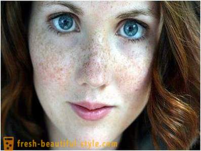 Menjaga kecantikan dan belia mereka: menyebabkan pigmentasi pada muka